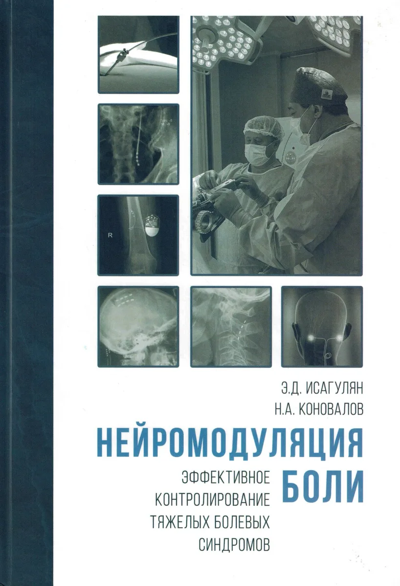 НЕЙРОМОДУЛЯЦИЯ БОЛИ. Эффективное контролирование тяжёлых болевых синдромов