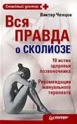 Вся правда о сколиозе