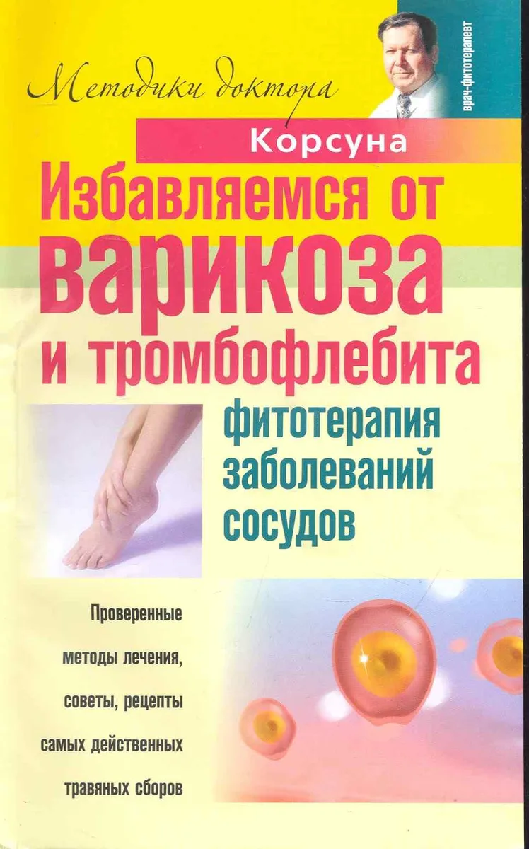 Избавляемся от варикоза и тромбофлебита. Фитотерапия заболеваний сосудов