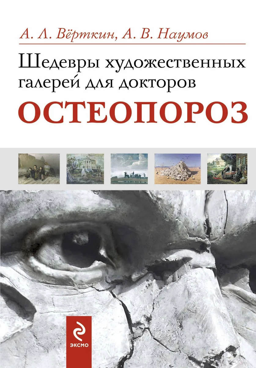 Шедевры художественных галерей для докторов. Остеопороз