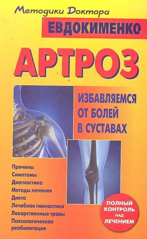 Артроз. Избавляемся от болей в суставах