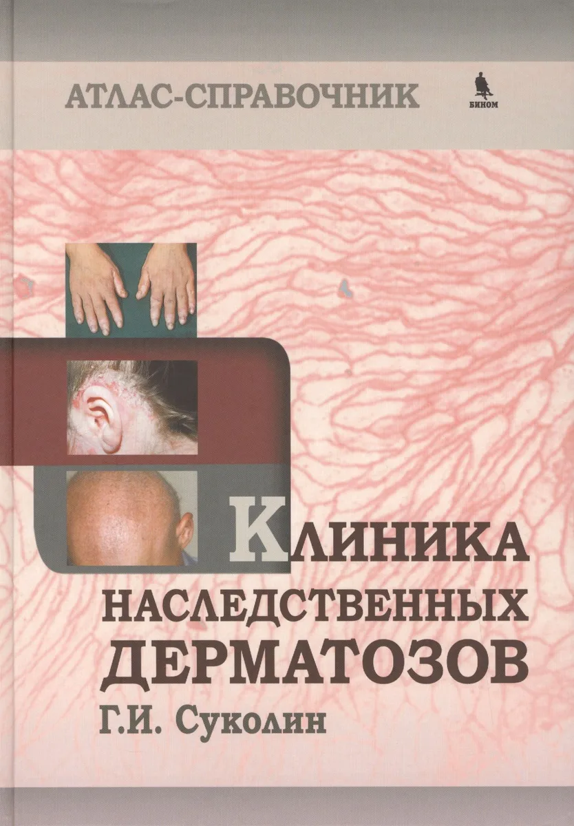 Клиника наследственных дерматозов. Атлас-справочник