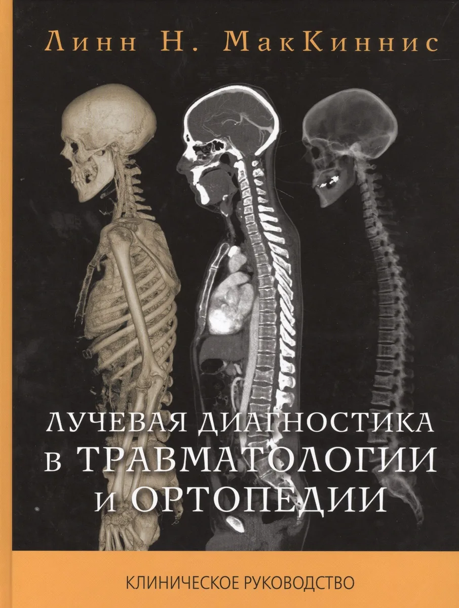 Лучевая диагностика в травматологии и ортопедии