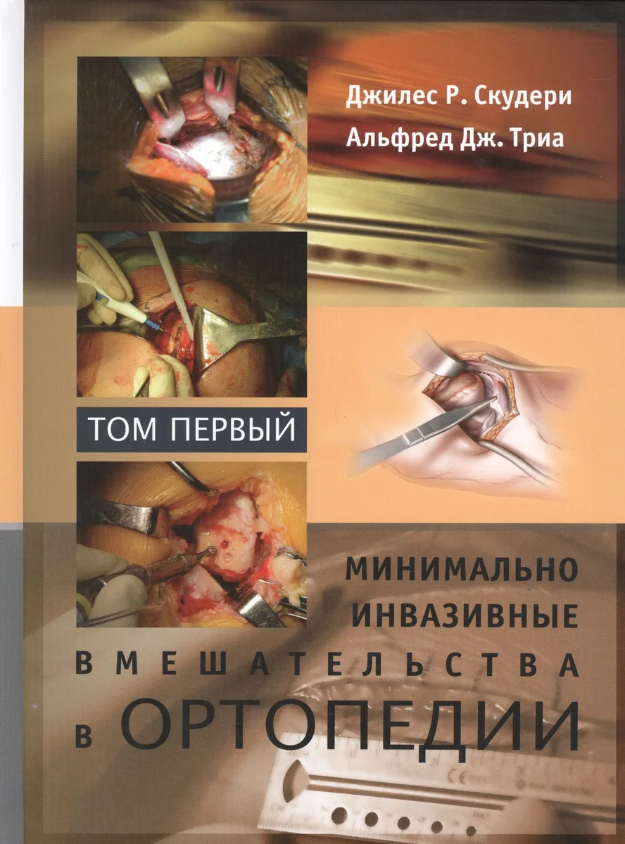 Минимально инвазивные вмешательства в ортопедии: в 2-х томах. Том 1