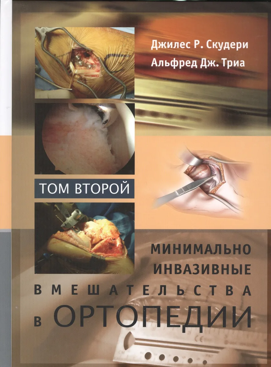 Минимально инвазивные вмешательства в ортопедии: в 2-х томах. Том 2
