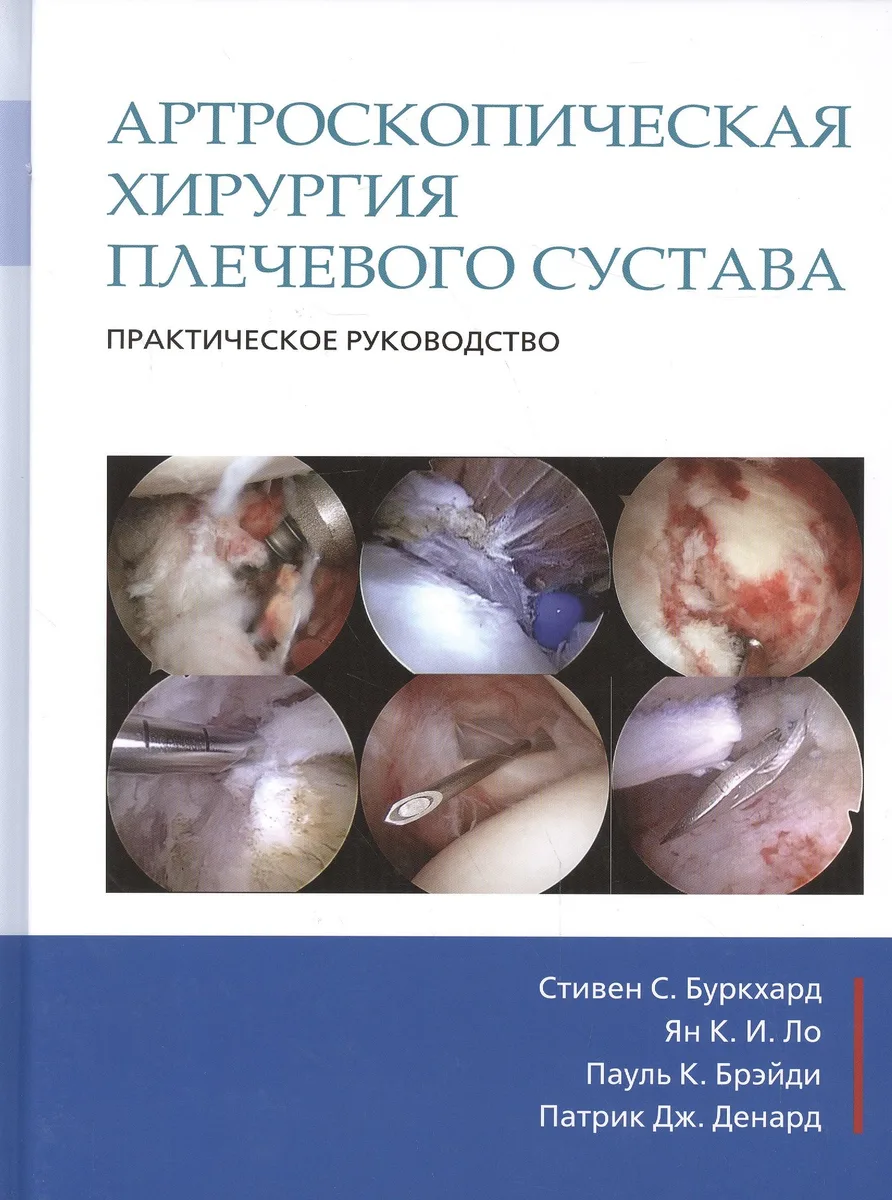 Артроскопическая хирургия плечевого сустава. Практическое руководство