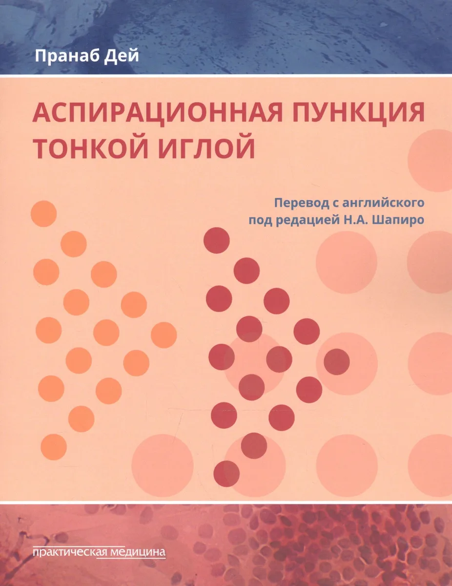 Аспирационная пункция тонкой иглой Трактовка результатов и диагност. проблемы (Дей)