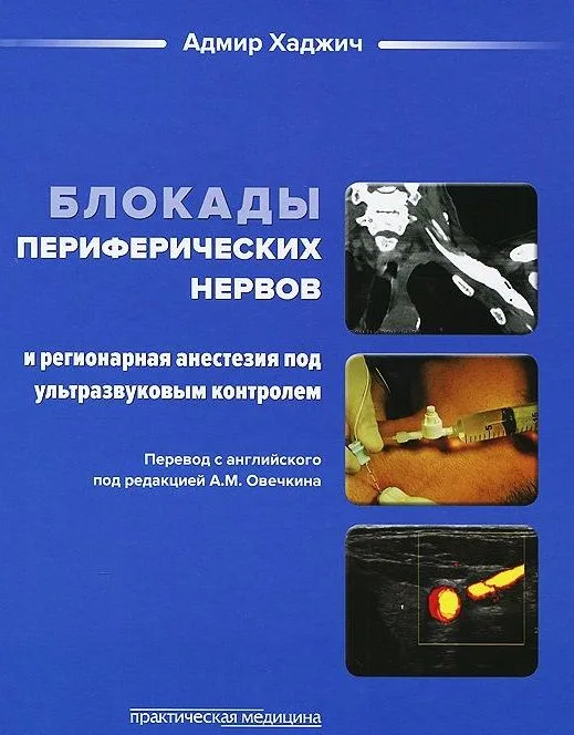 Блокады периферических нервов и регионарная анестезия под ультразвук. контролем (Хаджич)