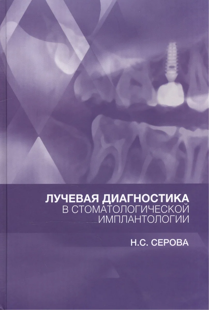 Лучевая диагностика в стоматологической имплантологии