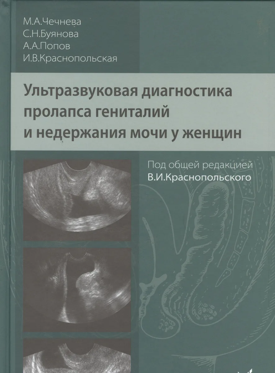 Ультразвуковая диагностика пролапса гениталий и недержания мочи у женщин