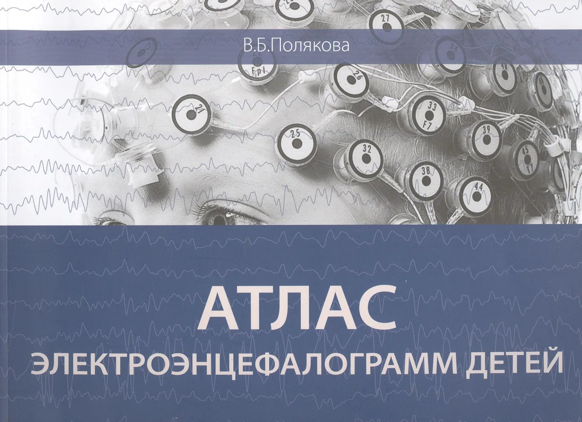 Атлас электроэнцефалограмм детей