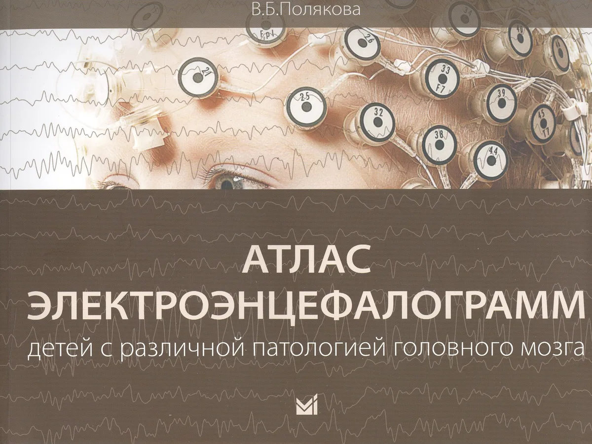 Атлас электроэнцефалограмм детей с различной патологией головного мозга