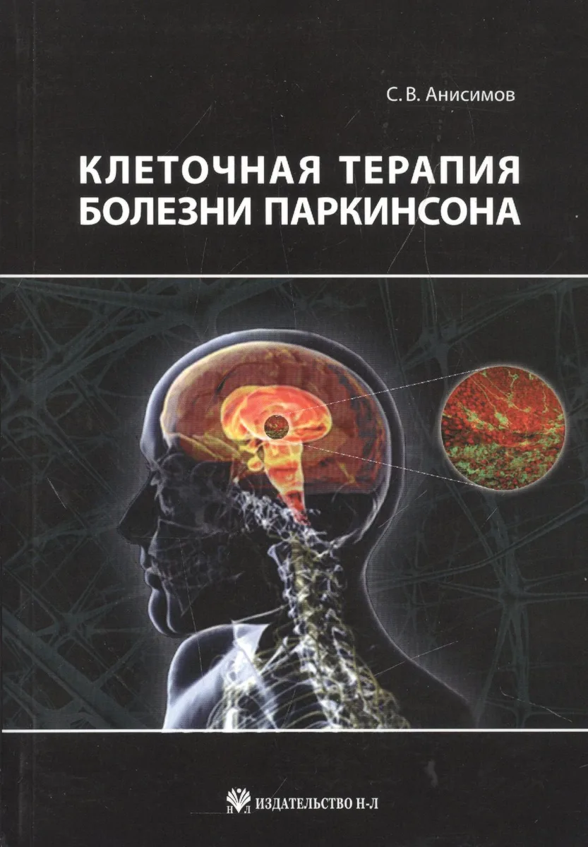 Клеточная терапия болезни Паркинсона
