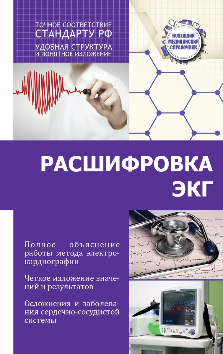 Расшифровка ЭКГ