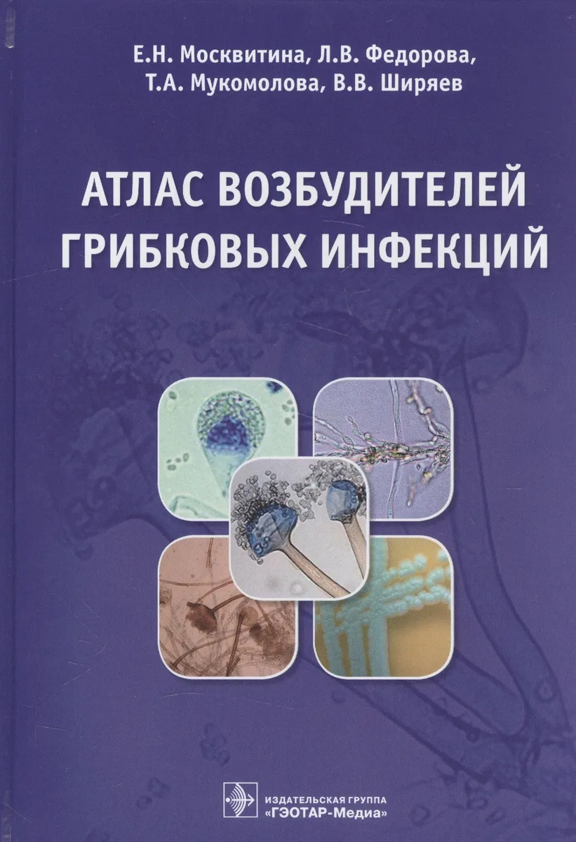 Атлас возбудителей грибковых инфекций (Москвитина)