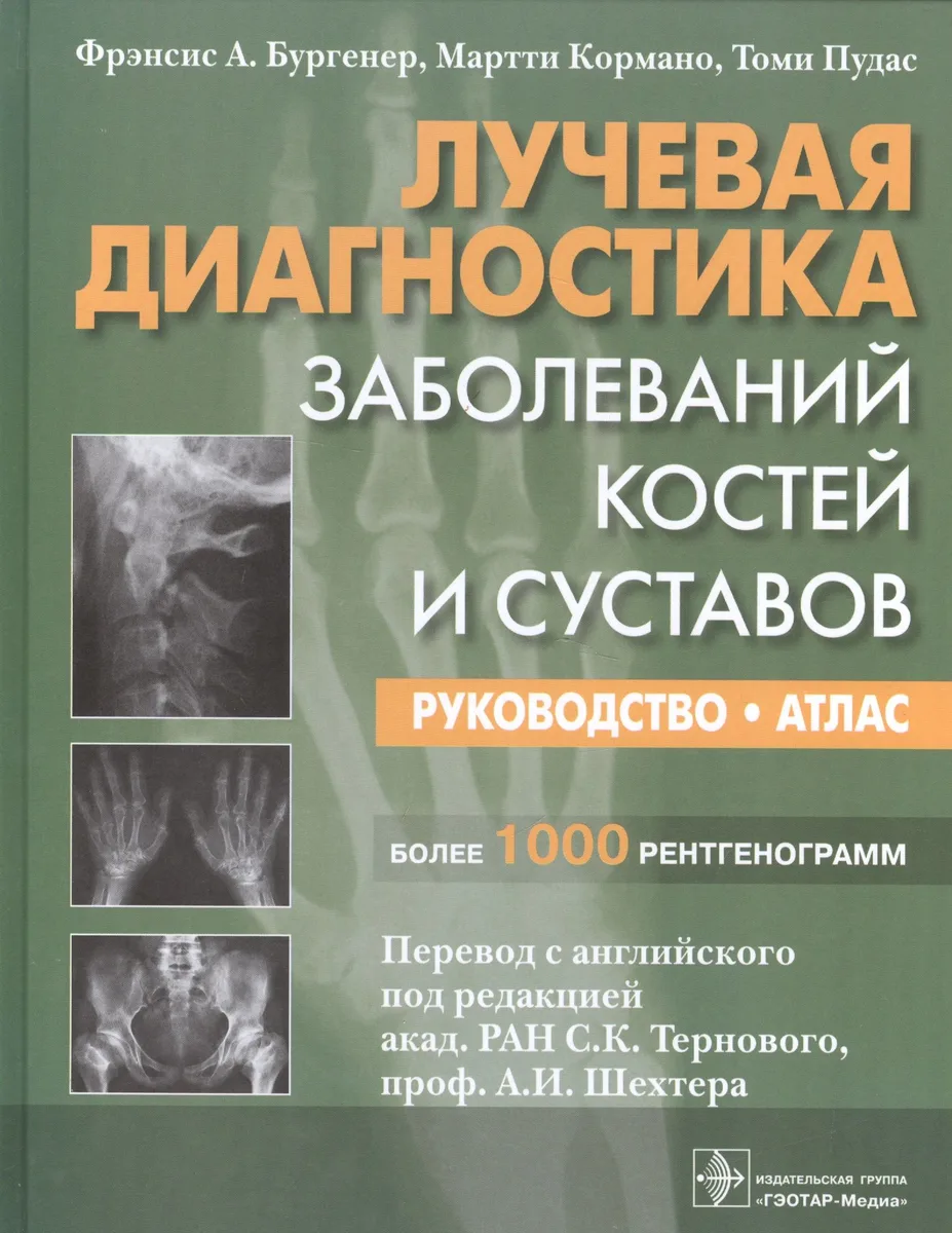 Лучевая диагностика Заболевание костей и суставов Рук-во Атлас (Бургенер)