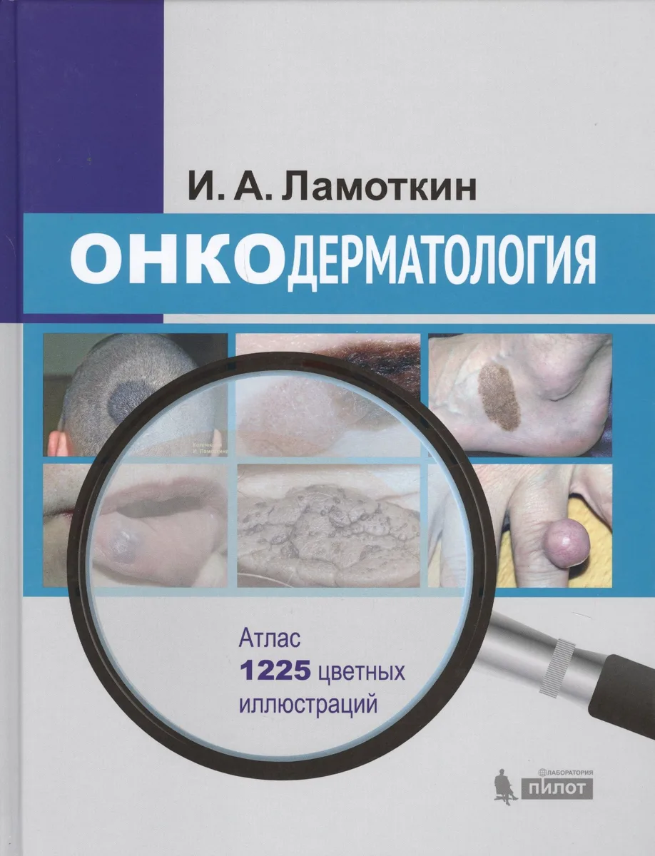 Онкодерматология: атлас: учебное пособие