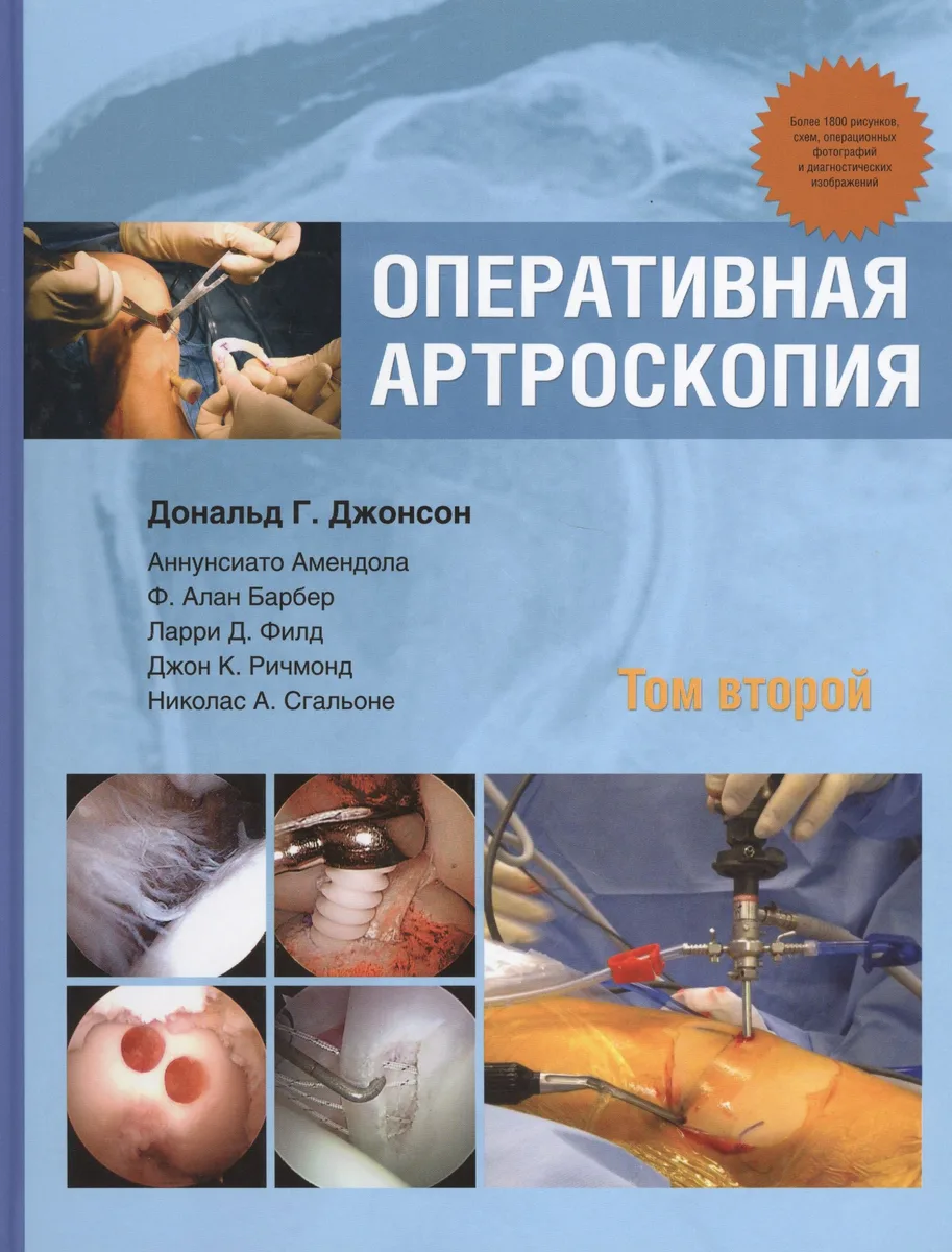 Оперативная артроскопия  т.2