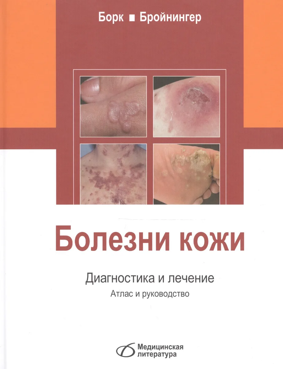Болезни кожи. Диагностика и лечение
