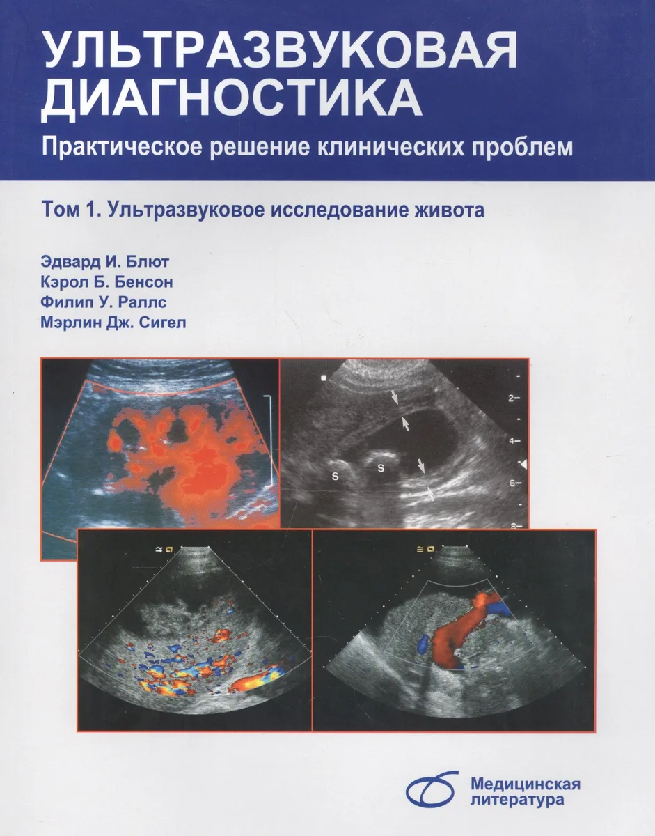 Ультразвуковая диагностика Практическое решение клинических проблем Том1  Ультразвуковое исследование живота