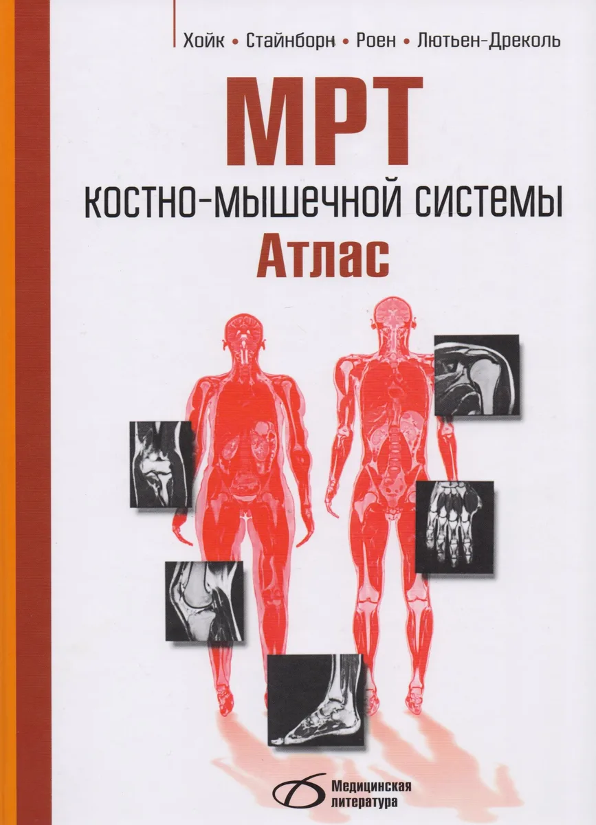 МРТ костно-мышечной системы. Атлас