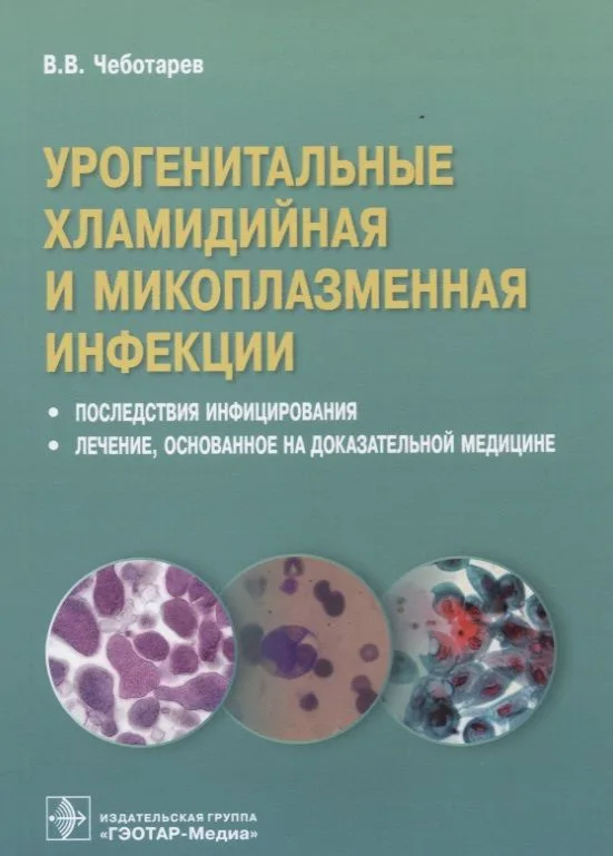 Урогенитальные хламидийная и микроплазменная инфекции. Последствия инфицирования. Лечение, основанное на доказательной медицине