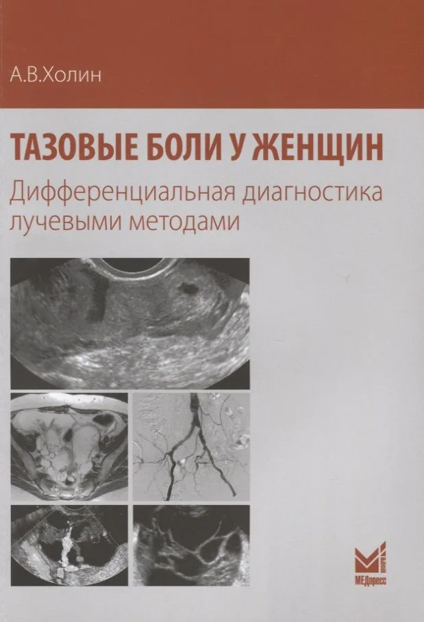 Тазовые боли у женщин Дифференциальная диагностика лучевыми методами (м) Холин