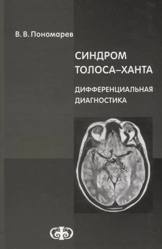 Синдром Толоса-Ханта. Дифференциальная диагностика