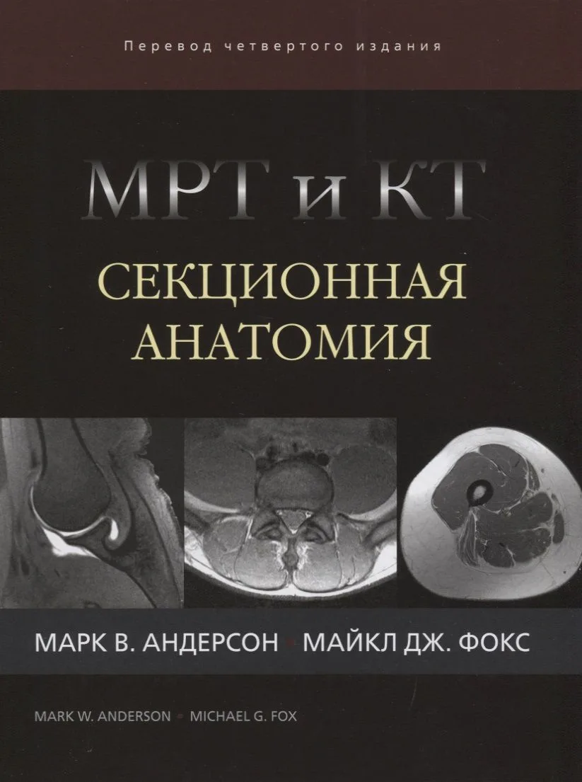 МРТ и КТ Секционная анатомия (4 изд) Андерсон