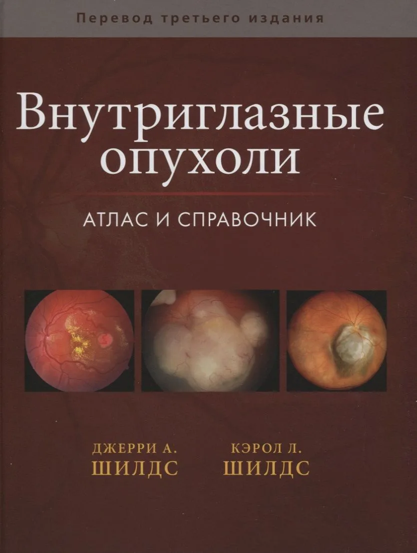 Внутриглазные опухоли. Атлас и справочник