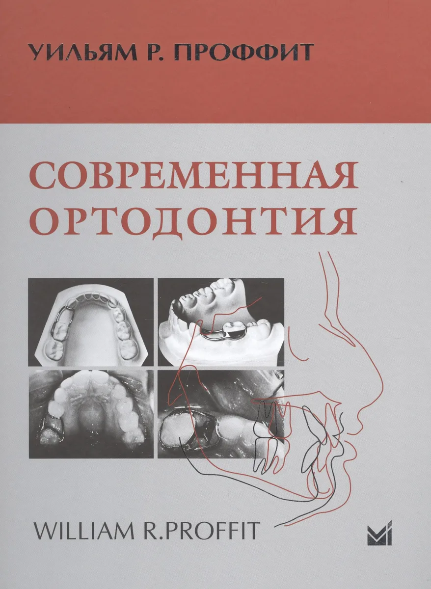 Современная ортодонтия