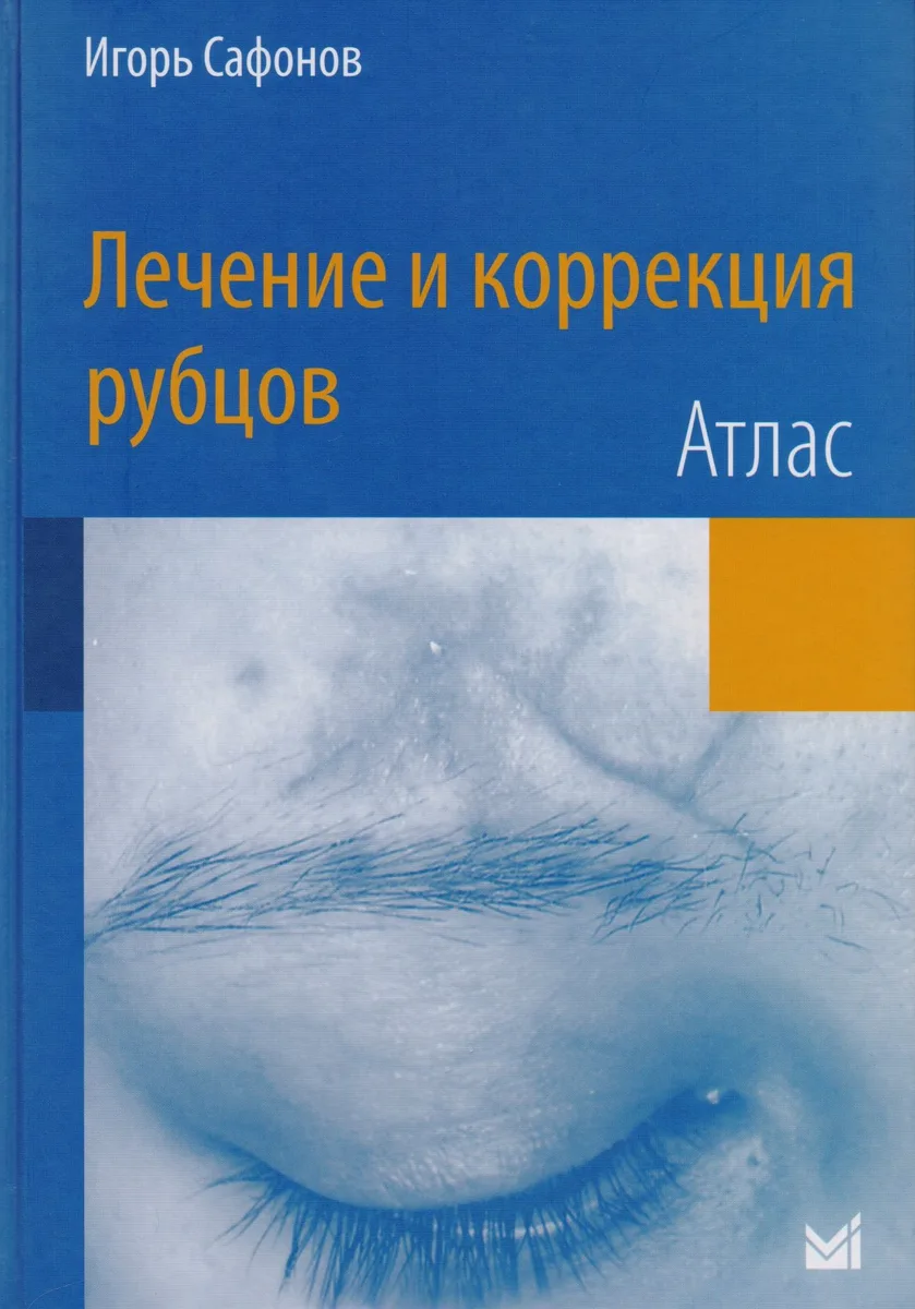 Лечение и коррекция рубцов.Атлас