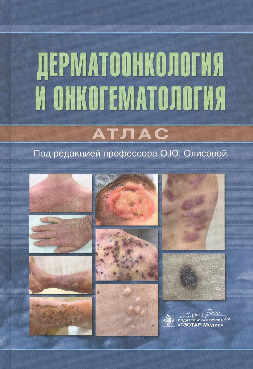 Дерматоонкология и онкогематология. Атлас