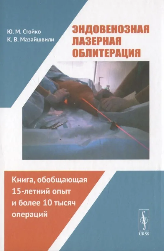 Эндовенозная лазерная облитерация
