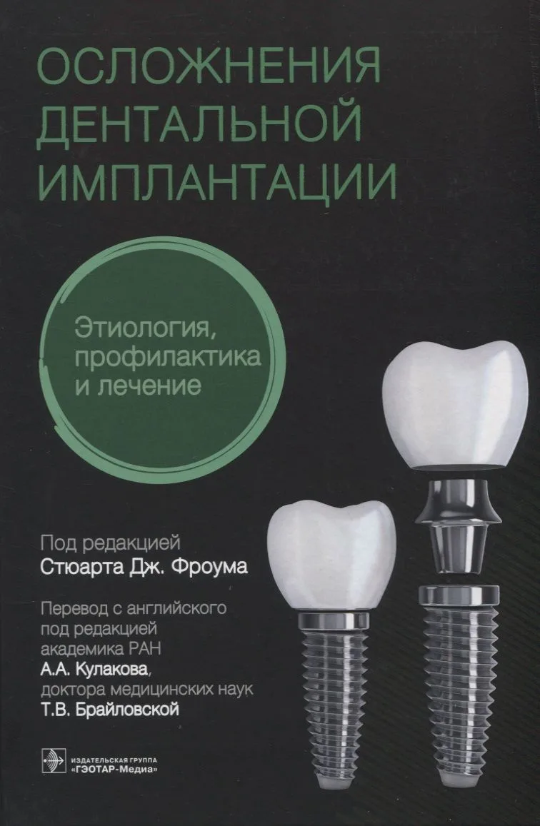 Осложнения дентальной имплантации. Этиология, профилактика и лечение