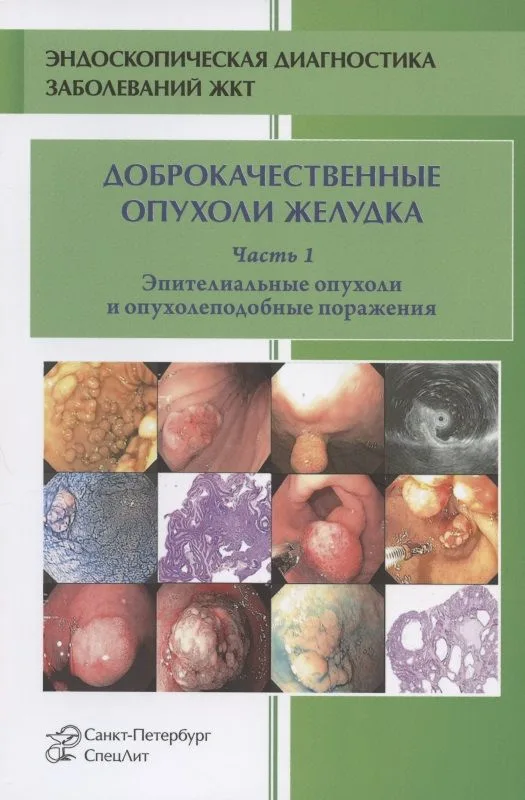 Доброкачественные опухоли желудка. Эпителиальные опухоли и опухолеподобные поражения. Часть 1. Учебно-методическое пособие
