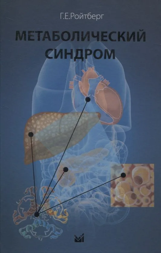 Метаболический синдром