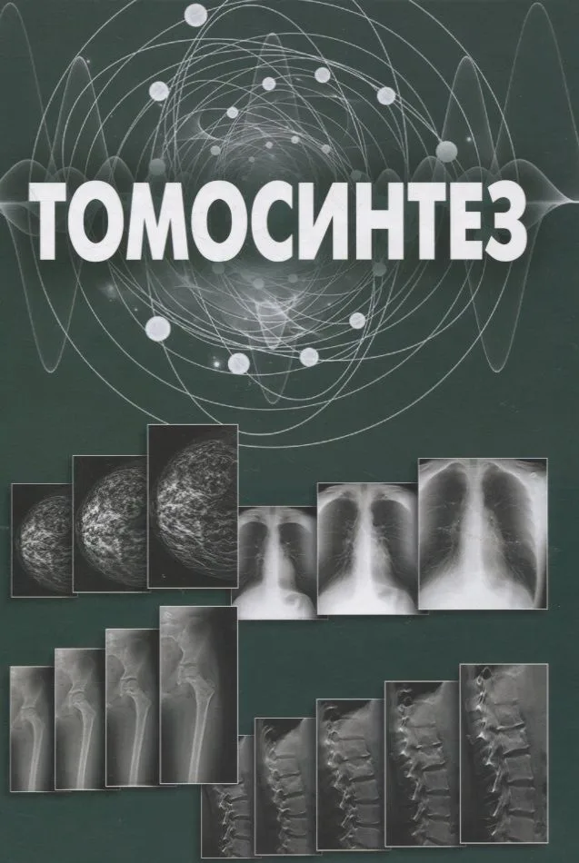 Томосинтез