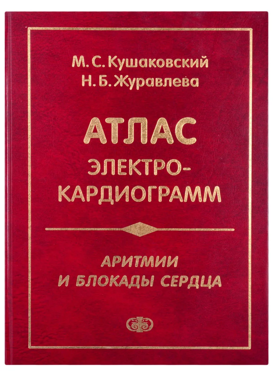 Атлас электрокардиограмм. Аритмии и блокады сердца